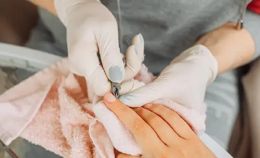 Nail Surgery