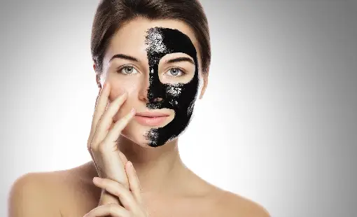 Carbon Laser Peel
