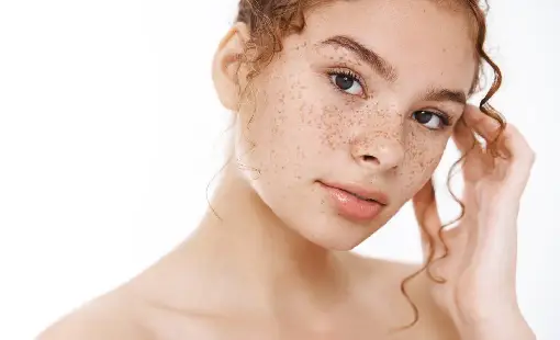 Pigmentation