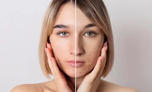Anti Ageing & Skin Rejuvenation