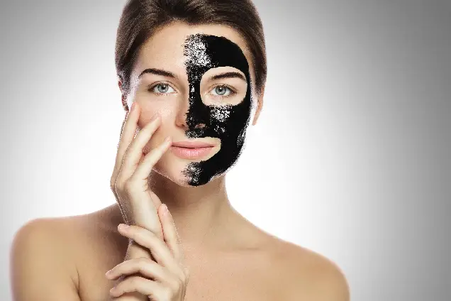 Carbon Laser Peel