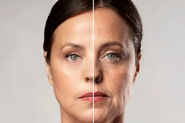 Procedure for skin tightening